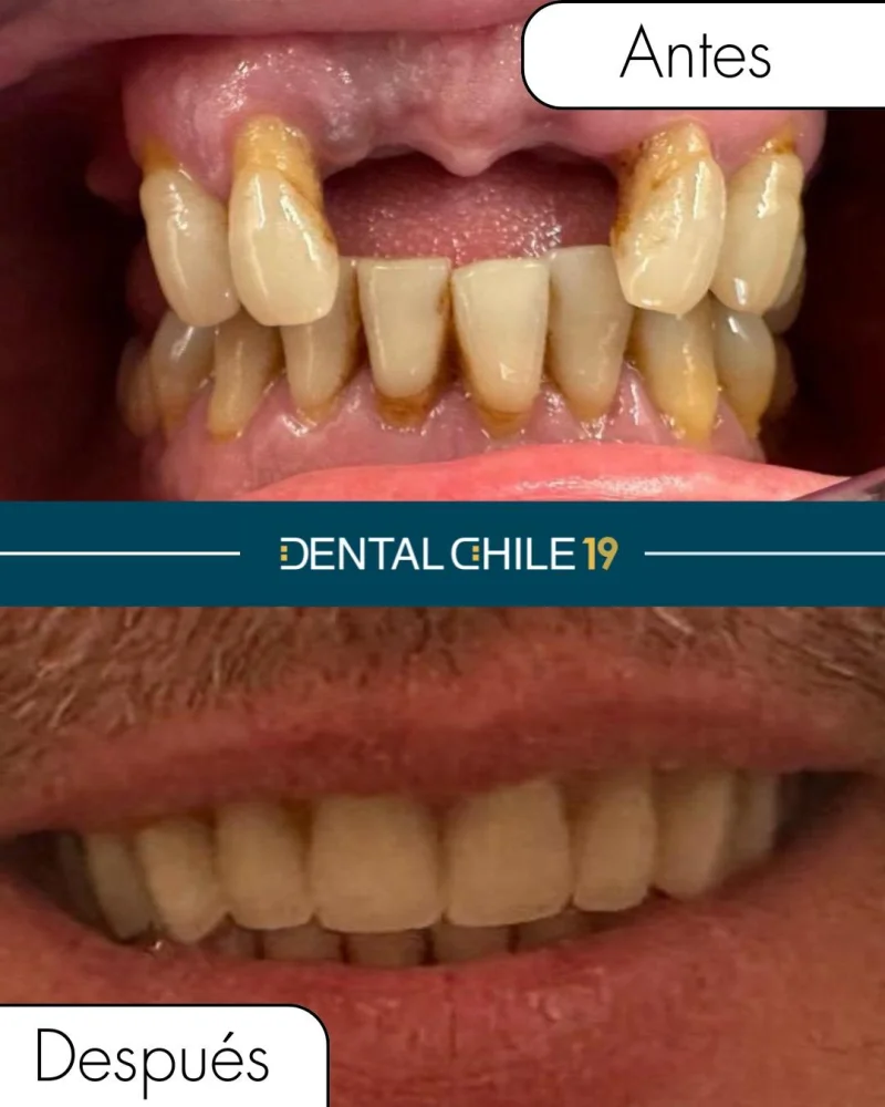 CLÍNICA DENTAL CHILE
