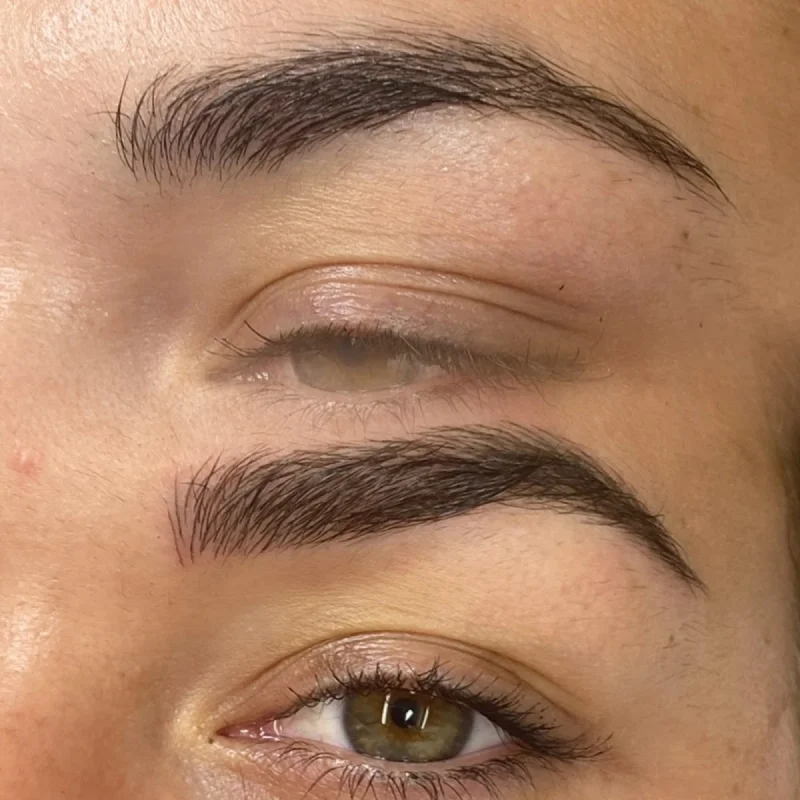 Línia Estètica